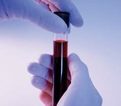Виды анализов крови. Для чего нужны различные анализы